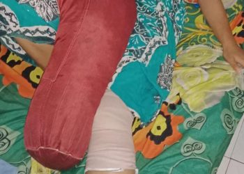 Anggota PASUTER (Pasukan Khusus Taruna) SMK Negeri Compreng Mendapat Musibah, Mohon Doa Dari Semua Pihak Agar Cepat Sehat